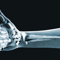 X Ray Imaging- Radiology